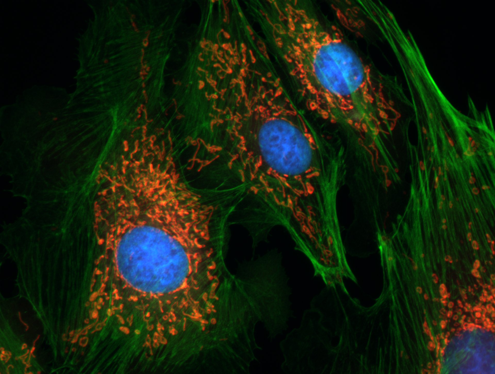 Light microscope image of animal cells. Four cells are visible. In each cell there is a large blue nucleus, about a hundred small red mitochondria and large amounts of a protein called actin, which is green. These colours are not the actual colours of the structures, but are the colours of fluorescent dyes that have been added to the cells.
